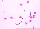 Bacillus-cereus
