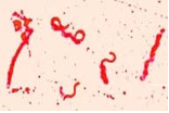 Campilobacter-jejuni