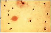 Clostridium-perfringens